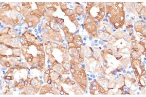 Immunohistochemistry of paraffin-embedded Human stomach using NHLRC1 Polyclonal Antibody at dilution of 1:100 (40x lens). (NHLRC1 anticorps)