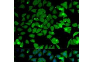Immunofluorescence analysis of U2OS cells using NAA10 Polyclonal Antibody (NAA10 anticorps)