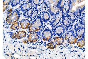 ABIN6256933 and ABIN6274579 at 1/100 staining Mouse colorectal tissue by IHC-P.