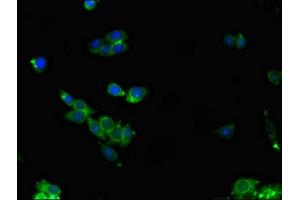 Immunofluorescent analysis of HepG2 cells using ABIN7153215 at dilution of 1:100 and Alexa Fluor 488-congugated AffiniPure Goat Anti-Rabbit IgG(H+L)