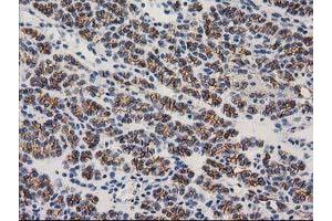 Image no. 5 for anti-Catenin (Cadherin-Associated Protein), beta 1, 88kDa (CTNNB1) antibody (ABIN1496889)