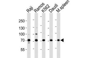 Western blot analysis of lysate from Raji, Ramos, K562, Daudi cell line and mouse spleen tissue lysate using BTK antibody at 1:1000.