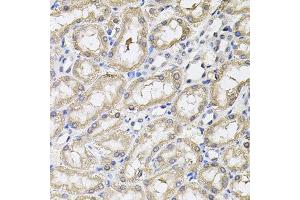 Immunohistochemistry of paraffin-embedded rat kidney using RNF166 antibody. (RNF166 anticorps)