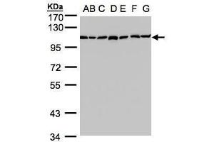 WB Image Sample(30 ug whole cell lysate) A: 293T B: A431 , C: H1299 D: HeLa S3 , E: Hep G2 , F: MOLT4 , G: Raji , 7.