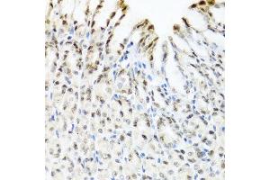 Immunohistochemistry of paraffin-embedded mouse stomach using YTHDF3 antibody at dilution of 1:100 (x40 lens). (YTHDF3 anticorps)