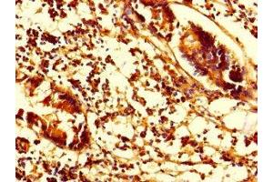 Immunohistochemistry of paraffin-embedded human appendix tissue using ABIN7170841 at dilution of 1:100 (SMAP1 anticorps  (AA 1-280))