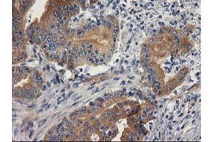 Immunohistochemistry (IHC) image for anti-Breast Cancer Anti-Estrogen Resistance 1 (BCAR1) antibody (ABIN1496833)