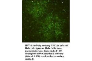 Image no. 1 for anti-Herpes Simplex Virus Type 1 (HSV1) antibody (ABIN791168) (Herpes Simplex Virus Type 1 (HSV1) anticorps)