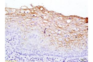 Formalin-fixed and paraffin embedded rat kidney tissue labeled with Rabbit Anti-Notch 2 Polyclonal Antibody, Unconjugated (ABIN680183) at 1:200 followed by conjugation to the secondary antibody and DAB staining.