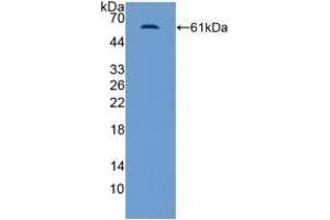 Detection of Recombinant MR, Human using Polyclonal Antibody to Mineralocorticoid Receptor (MR) (NR3C2 anticorps  (AA 739-984))