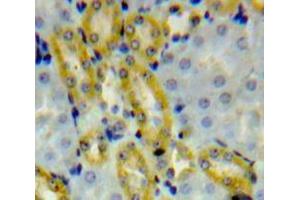 Used in DAB staining on fromalin fixed paraffin-embedded Kidney tissue (ALDH1A3 anticorps  (AA 332-509))