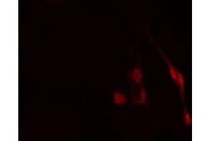 ABIN6274262 staining HuvEc cells by IF/ICC.