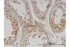 Image no. 1 for anti-DNA Methyltransferase 1-Associated Protein 1 (DMAP1) (AA 1-101) antibody (ABIN599578) (DMAP1 anticorps  (AA 1-101))