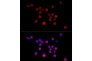 Immunofluorescence analysis of Neuro-2a cells using Nestin Rabbit pAb (ABIN6128335, ABIN6144536, ABIN6144537 and ABIN6215496) at dilution of 1:50 (40x lens).