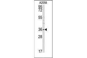 Western blot analysis of anti-ANXA2 Antibody (C-term) in A2058 cell line lysates (35ug/lane). (Annexin A2 anticorps  (C-Term))