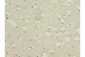 Immunohistochemistry of paraffin-embedded human brain tissue using ABIN7174836 at dilution of 1:100 (C3orf18 anticorps  (AA 83-162))