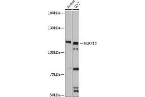 Western blot analysis of extracts of various cell lines, using NLRP12 antibody (ABIN7268938) at 1:3000 dilution.