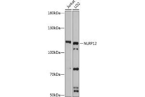 Western blot analysis of extracts of various cell lines, using NLRP12 antibody (ABIN7268938) at 1:3000 dilution. (NLRP12 anticorps  (AA 862-1062))