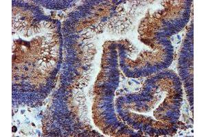 Immunohistochemistry (IHC) image for anti-Protein Disulfide Isomerase Family A, Member 4 (PDIA4) antibody (ABIN1500110)