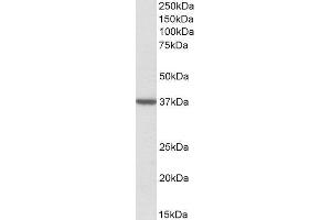 ABIN2560487 (2µg/ml) staining of Human Frontal Cortex lysate (35µg protein in RIPA buffer). (TOMM40 anticorps  (Internal Region))