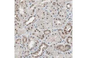 Immunohistochemical staining of human kidney with LONP2 polyclonal antibody  shows strong nuclear and weak cytoplasmic positivity in cells in tubules. (LONP2 anticorps)