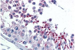 Human Testis: Formalin-Fixed, Paraffin-Embedded (FFPE)