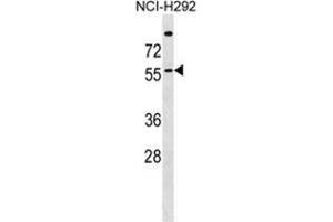 ZDHHC13 Antibody (N-term) western blot analysis in NCI-H292 cell line lysates (35 µg/lane). (ZDHHC13 anticorps  (N-Term))