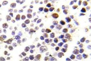 Immunohistochemistry (IHC) analyzes of p-Histone H3.