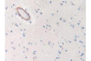 Figure. (CD15 anticorps  (AA 264-497))
