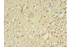 Immunohistochemistry of paraffin-embedded human brain tissue using ABIN7167621 at dilution of 1:100 (RGS7 anticorps  (AA 1-487))