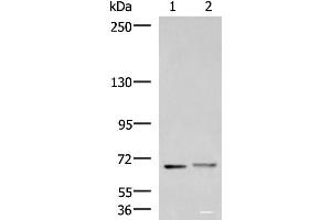 Western blot analysis of Mouse brain tissue and Human cerebrum tissue lysates using EXD2 Polyclonal Antibody at dilution of 1:700 (EXD2 anticorps)