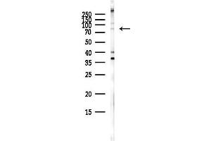 anti-Leucine Rich Repeat Containing 41 (LRRC41) (Internal Region) antibody