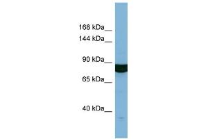 Host:  Rabbit  Target Name:  HACE1  Sample Type:  OVCAR-3 Whole cell lysates  Antibody Dilution:  1.