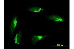 Immunofluorescence of purified MaxPab antibody to GORASP1 on HeLa cell.