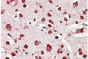 Image no. 1 for anti-Scavenger Receptor Class B, Member 2 (SCARB2) (Internal Region) antibody (ABIN375158) (SCARB2 anticorps  (Internal Region))