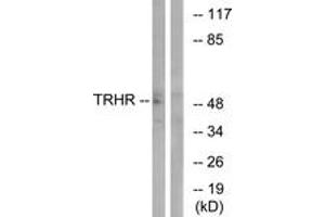 Western blot analysis of extracts from COS7 cells, using TRHR Antibody. (TRHR anticorps  (AA 195-244))