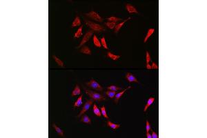 Immunofluorescence analysis of NIH/3T3 cells using SHP2 Rabbit mAb (ABIN7269704) at dilution of 1:100 (40x lens). (PTPN11 anticorps)