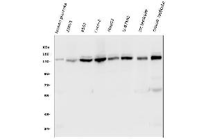 Western blot analysis of HAUSP/USP7 using anti-HAUSP/USP7 antibody (ABIN6719603). (USP7 anticorps  (AA 258-483))