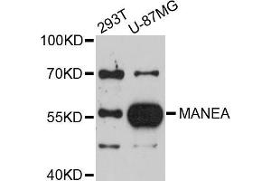 Western blot analysis of extracts of various cell lines, using MANEA antibody (ABIN5998166) at 1/1000 dilution. (MANEA anticorps)
