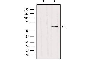 Western blot analysis of extracts from Hepg2, using MMP11 Antibody. (MMP11 anticorps  (N-Term))