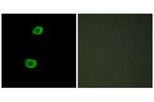 Immunofluorescence analysis of HepG2 cells, using LMTK2 antibody. (LMTK2 anticorps  (Internal Region))