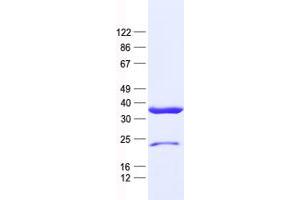 Validation with Western Blot (PRKAB2 Protein (His tag))