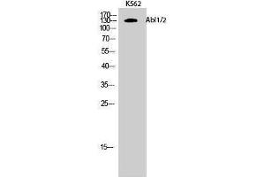 Western Blotting (WB) image for anti-Abelson Murine Leukemia Viral Oncogene Homolog 1/2 (ABL1/ABL2) (Lys5) antibody (ABIN3183134) (ABL1/2 anticorps  (Lys5))