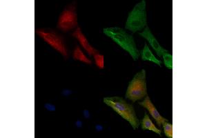 ABIN6262759 and ABIN6279680 staining  cells by IF/ICC.