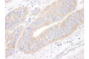 anti-KIAA1524 (KIAA1524) (AA 550-600) antibody