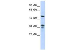 Image no. 1 for anti-Zinc Finger Protein 765 (ZNF765) (AA 108-157) antibody (ABIN6743557) (ZNF765 anticorps  (AA 108-157))