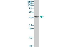 Western Blotting (WB) image for anti-Acetyl-CoA Acyltransferase 1 (ACAA1) (AA 217-316) antibody (ABIN599345) (ACAA1 anticorps  (AA 217-316))