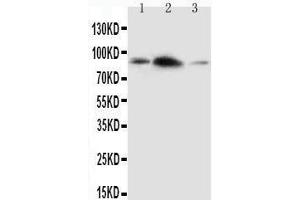 Anti-APLP2 antibody,  Western blotting Lane 1: Rat Brain Tissue Lysate Lane 2: Rat Heart Tissue Lysate Lane 3: SMMC Cell Lysate (APLP2 anticorps  (C-Term))
