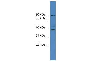 WB Suggested Anti-ZRANB1 Antibody Titration: 0. (ZRANB1 anticorps  (C-Term))