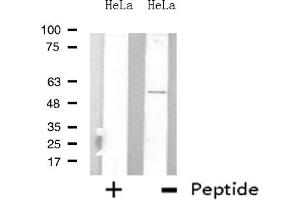 Western blot analysis of extracts from HeLa cells, using ARFGAP3 antibody. (ARFGAP3 anticorps  (C-Term))